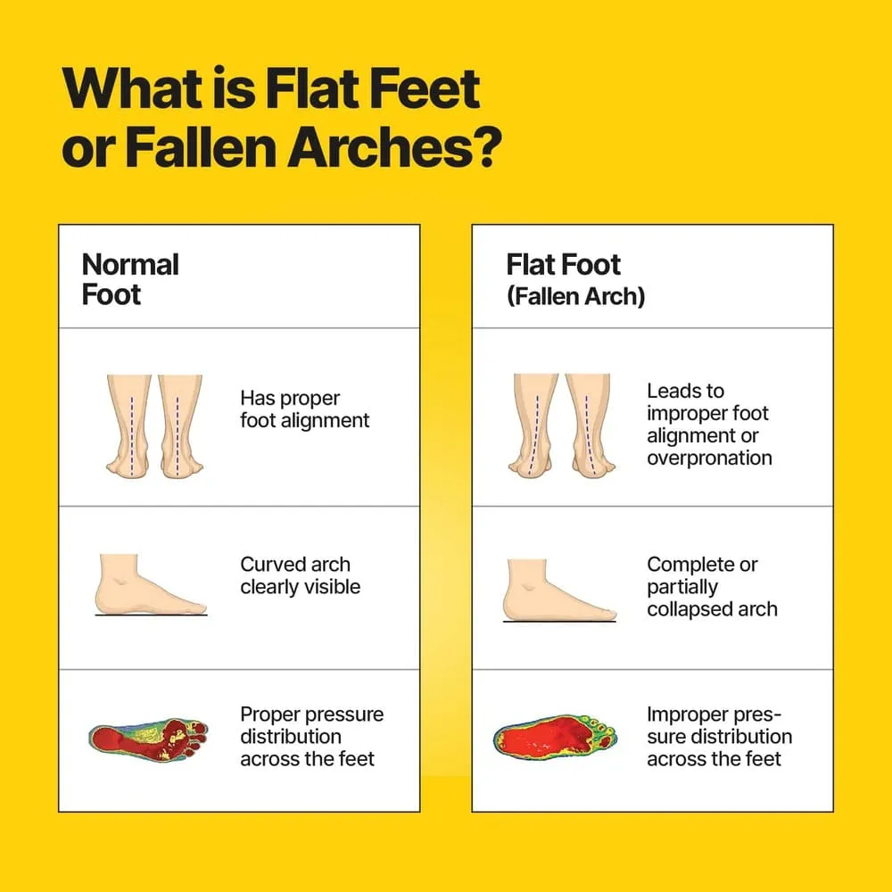 Frido Arch Support Insoles Rigid   Semi Rigid Combo